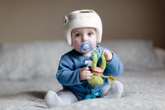 Cranial remolding orthosis or baby helmet
