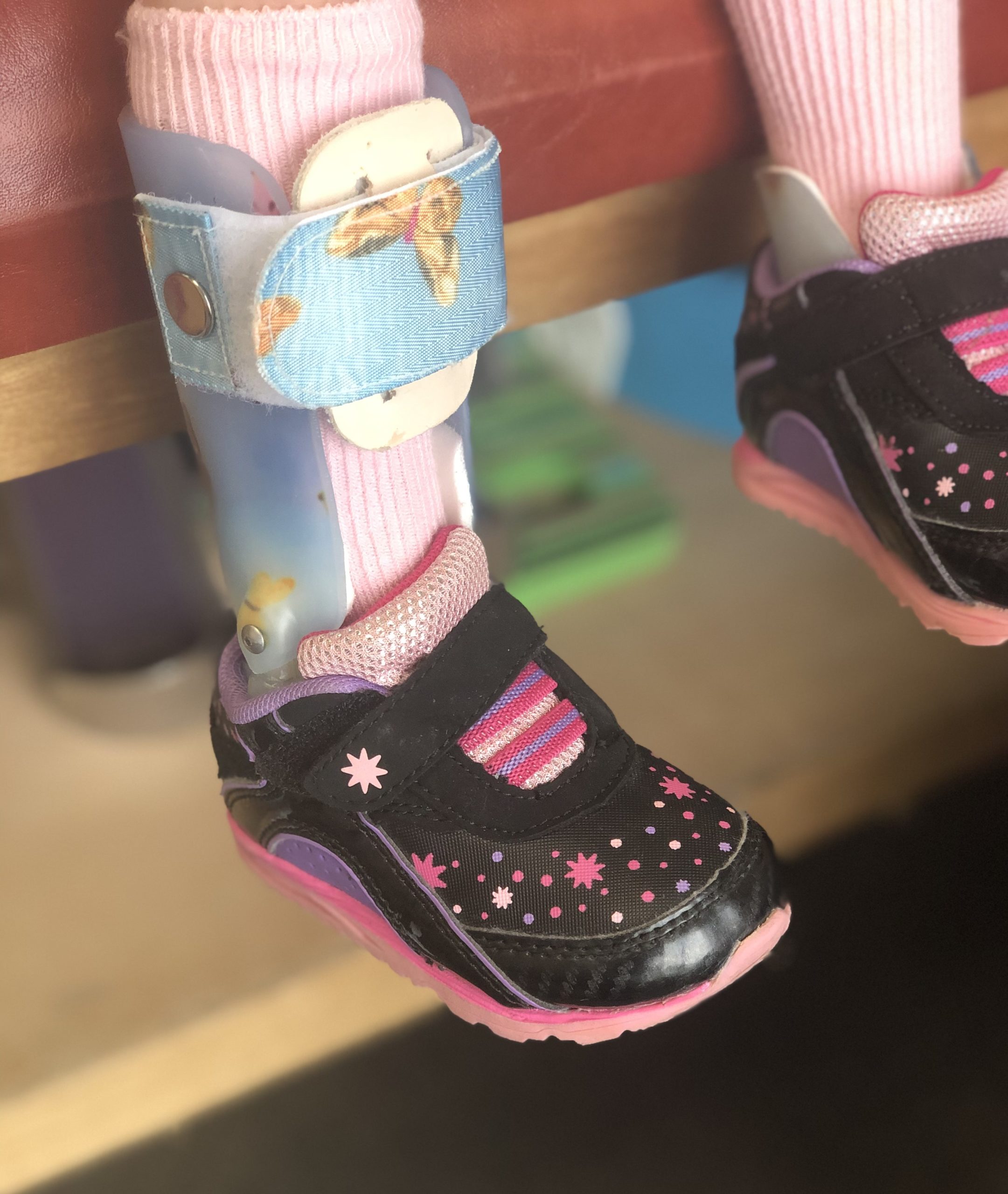 Paediatric ankle foot orthoses (AFO or leg braces)