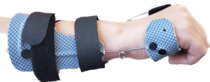 Custom wrist hand orthosis